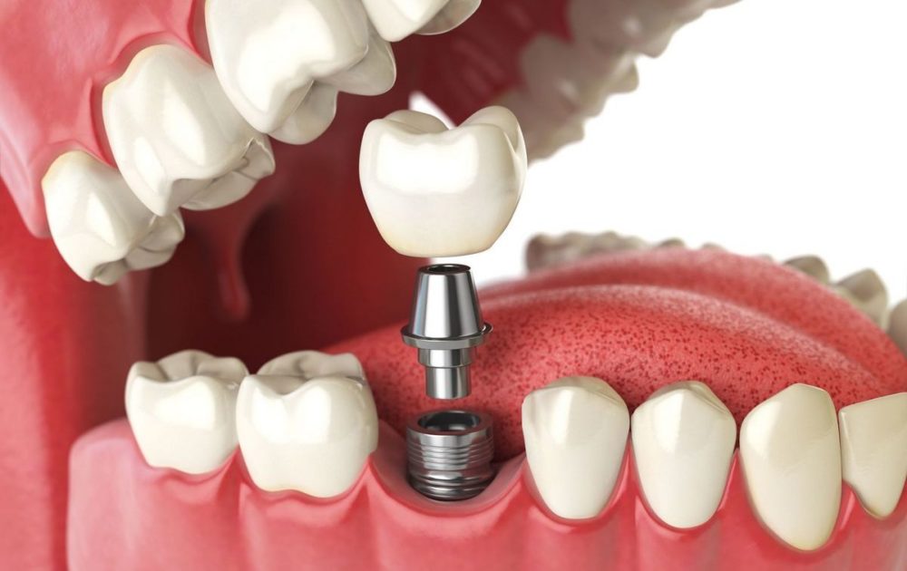 Ортопедическая Стоматология Dental Studio в Запорожье. Стоматолог терапевт в Запорожье