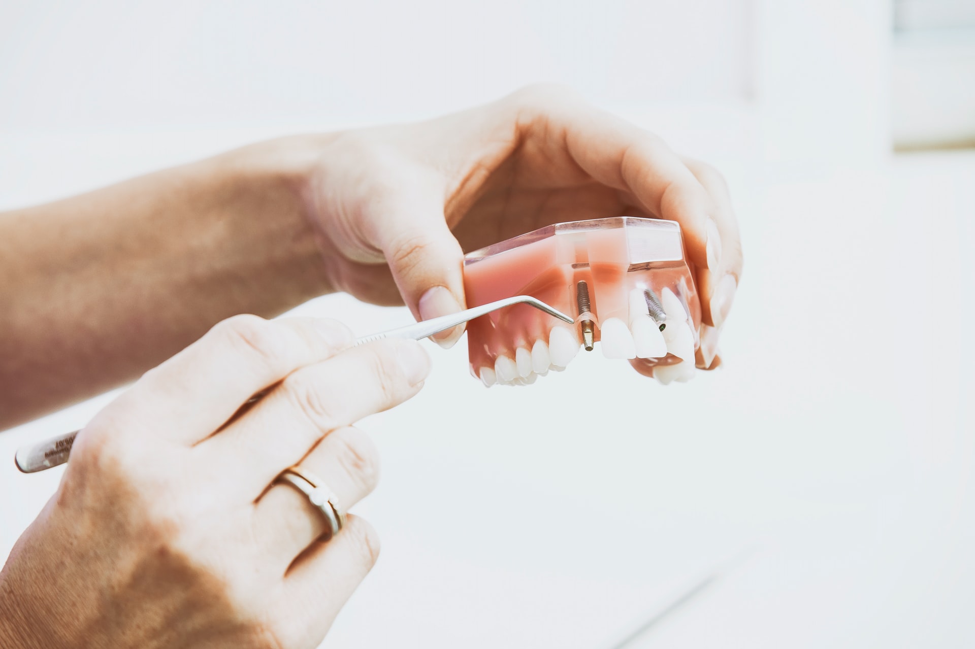Протезирование зубов в Запорожье - Стоматология Dental Studio