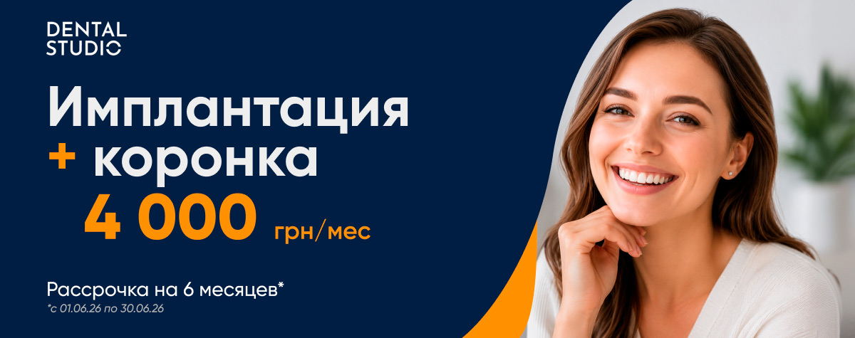 Импл RU