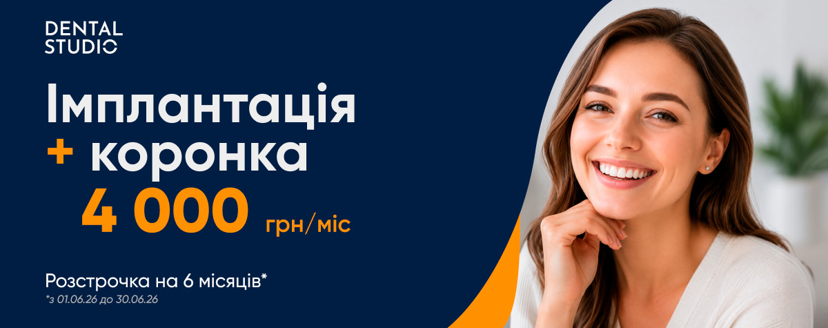 Импл UA