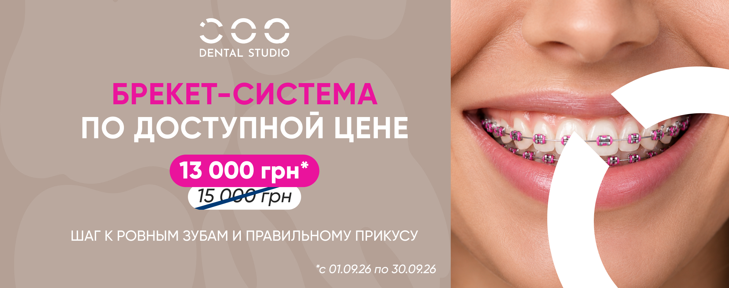Брекеты по доступной цене